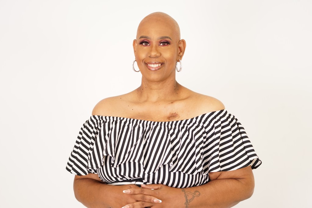 Hold On, Sis: Let Me Take My Wig Off — Staci Kirk’s Story of Strength and&nbsp;Healing